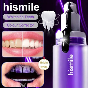 HiSmile™ - Visibly White Teeth From First Wash